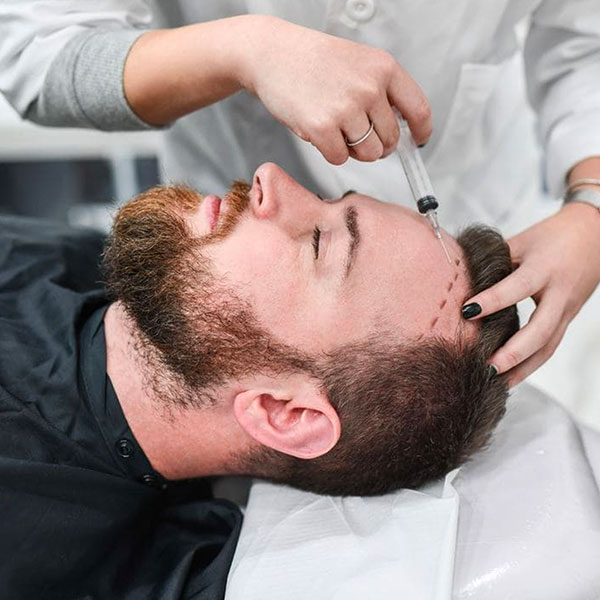 local anesthesia hair transplant